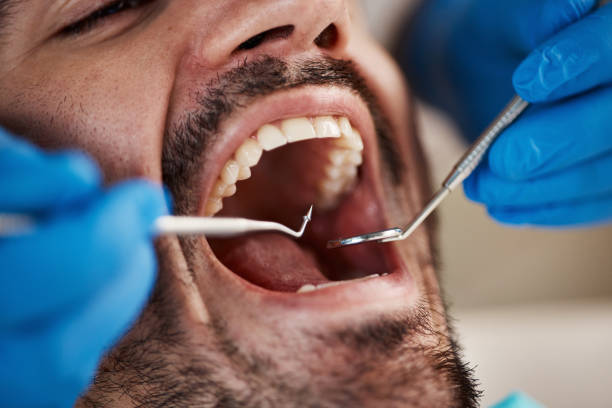 TMJ/TMD Treatment in Hidden Springs, ID